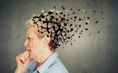 Dünya Alzheimer Günü